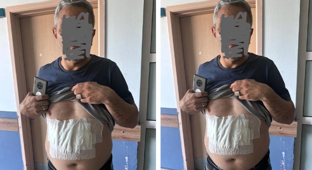 Akçakale’de kaynar su döküldüğü iddiası