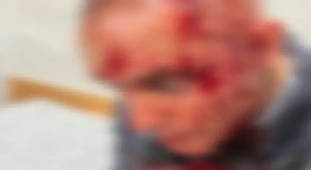 Urfa’da Zabıta Memuru Saldırıya Uğradı!