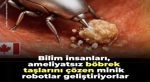 Böbrek Taşlarını Eriten Mini Robot Teknolojisi Geliştiriliyor