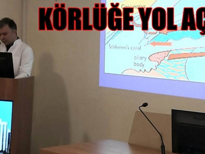 Göz tansiyonu belirti ve tedavi yöntemleri anlatıldı