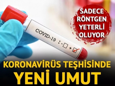 Koronavirüs teşhisinde yeni umut: COVID-Net