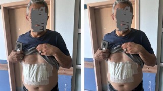 Akçakale’de kaynar su döküldüğü iddiası