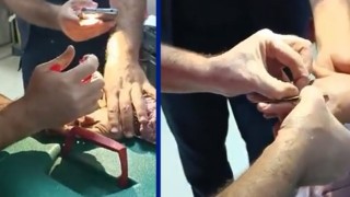 Parmağa sıkışan yüzüğü hastanede doktor çıkardı