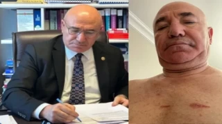 "Polis Şiddeti ve Hukuksuzluk: 'Bu Yaralar Sadece Bedende Değil, Hukuk Devletinde Açılmıştır!'"