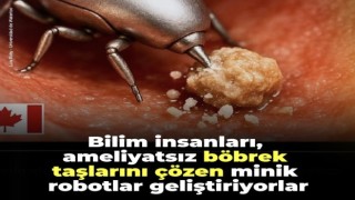 Böbrek Taşlarını Eriten Mini Robot Teknolojisi Geliştiriliyor